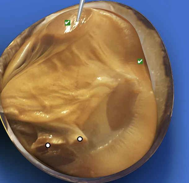 <p>What structure is this pointing to?</p>