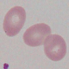 <p>Ovalocyte / Elliptocyte</p>