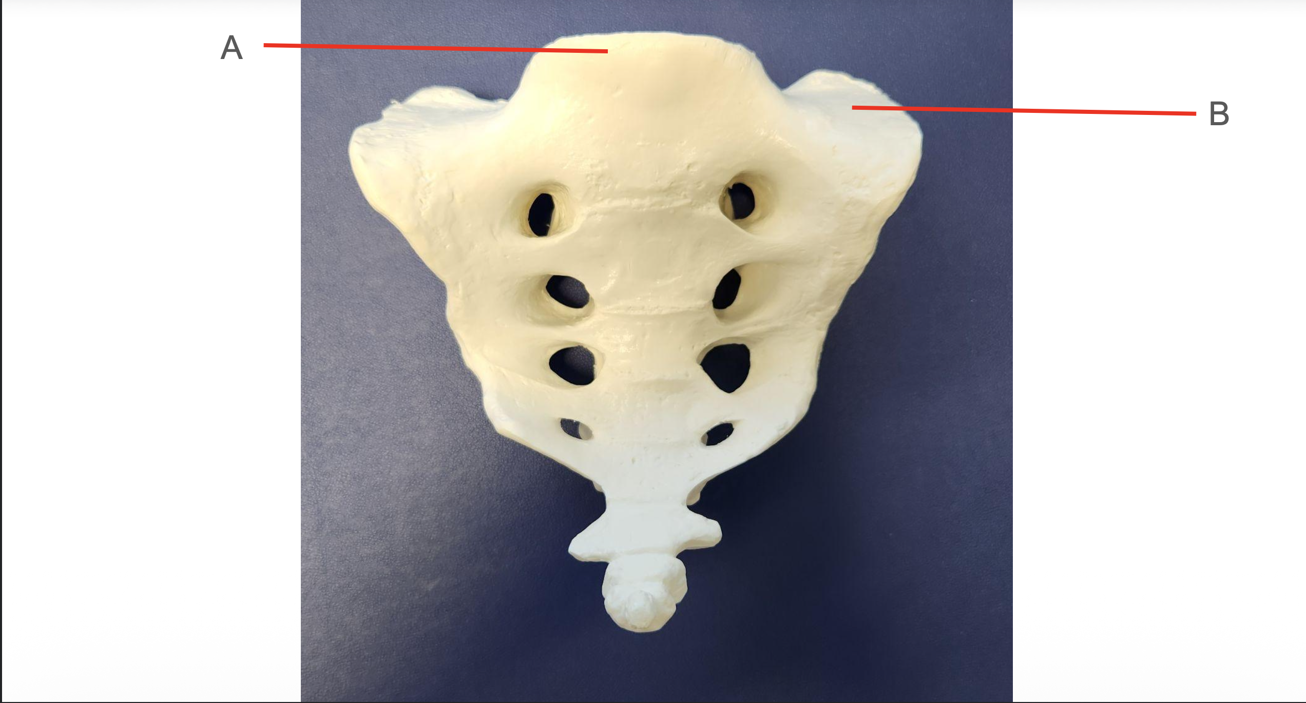 <p>Identify Structure B</p>