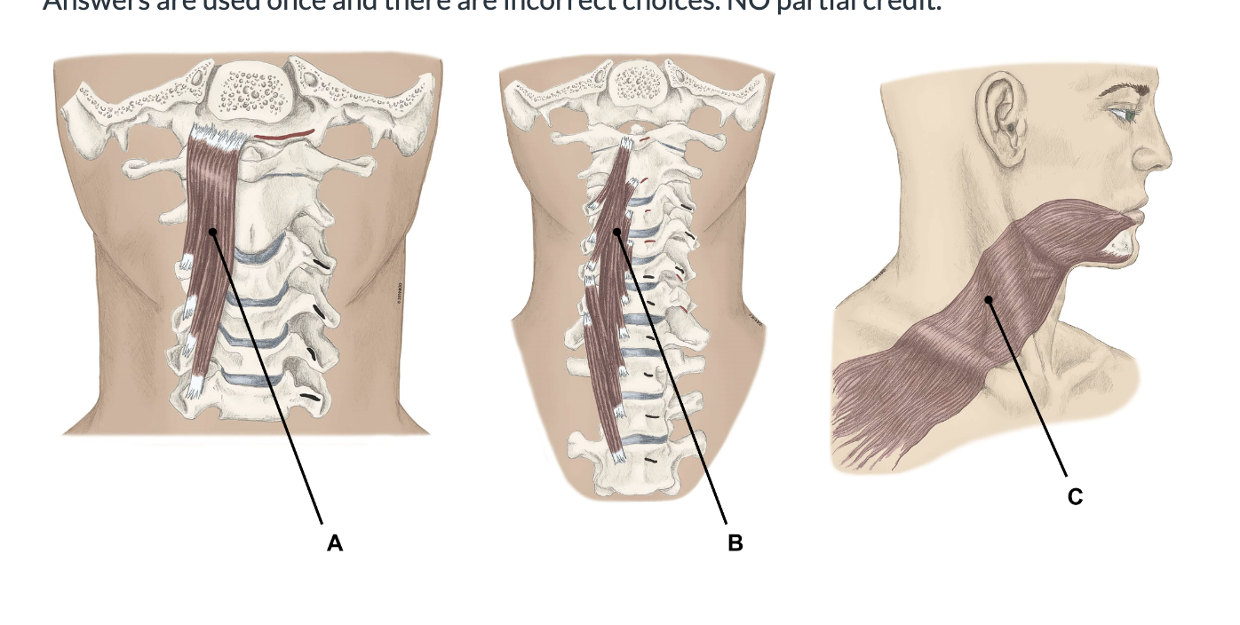 <p><span>Match the appropriate term with the landmark or structure identified in the picture below. Answers are used once and there are incorrect choices. NO partial credit.</span></p>