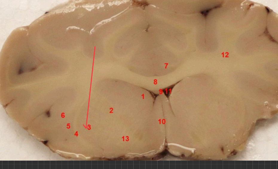 <p>what nuclei is this ? function </p>