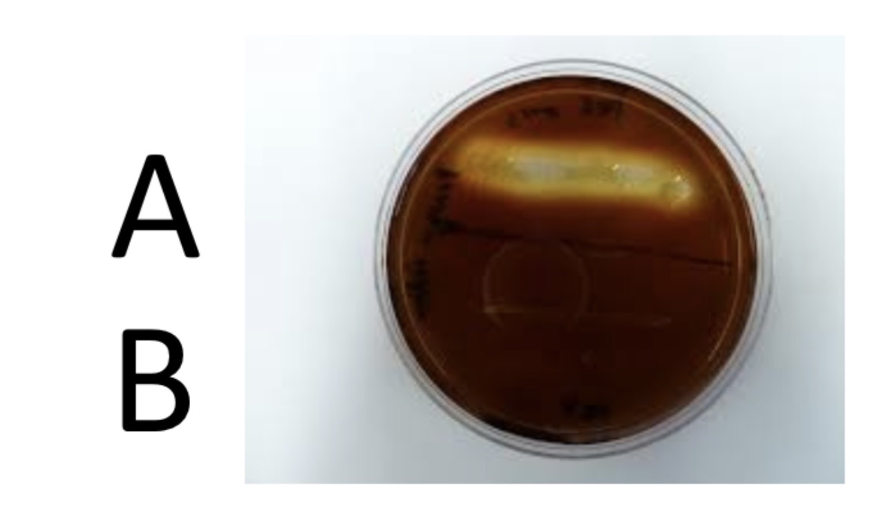<p>Starch Hydrolysis</p><p>a) Medium?</p><p>b) Substrate?</p><p>c) Enzyme?</p><p>d) Indicator/Reagent?</p><p>e) End Product?</p>