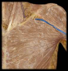 <p>Identify the structure</p>