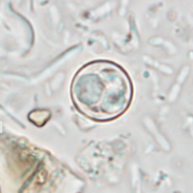 <p>genus, species, stage</p>