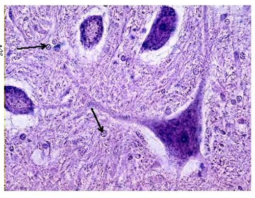 <p>Neuroglias:</p><ul><li><p>less Nissl substance (nucleic acids)</p><ul><li><p>smaller and generally do not have a prominent nucleolus.</p></li></ul></li><li><p>nuclei have a speckled appearance</p></li></ul><p></p><p></p><p></p><p></p>