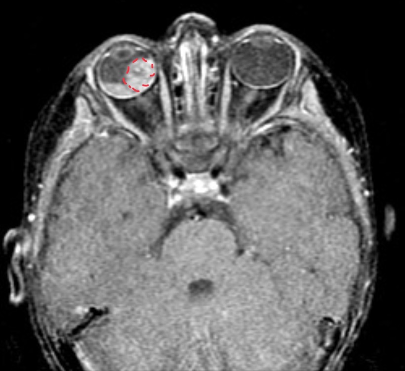 <p>Child presents with no available information</p>