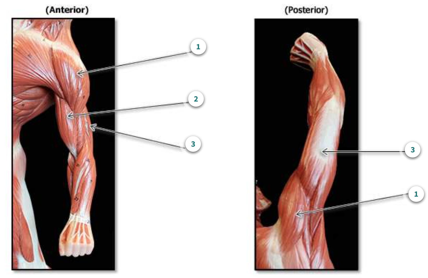 <p>What part of the body are these muscles a part of?</p>