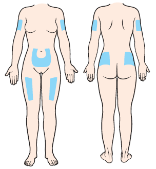 <p>Advantages: small, less painful needles used (insulin, heparin)</p><p>Disadvantages: small amount of drug (up to 1 mL), slow absorption</p><p>irritating to sub-Q tissue-pain, risk of necrosis and abscess</p>