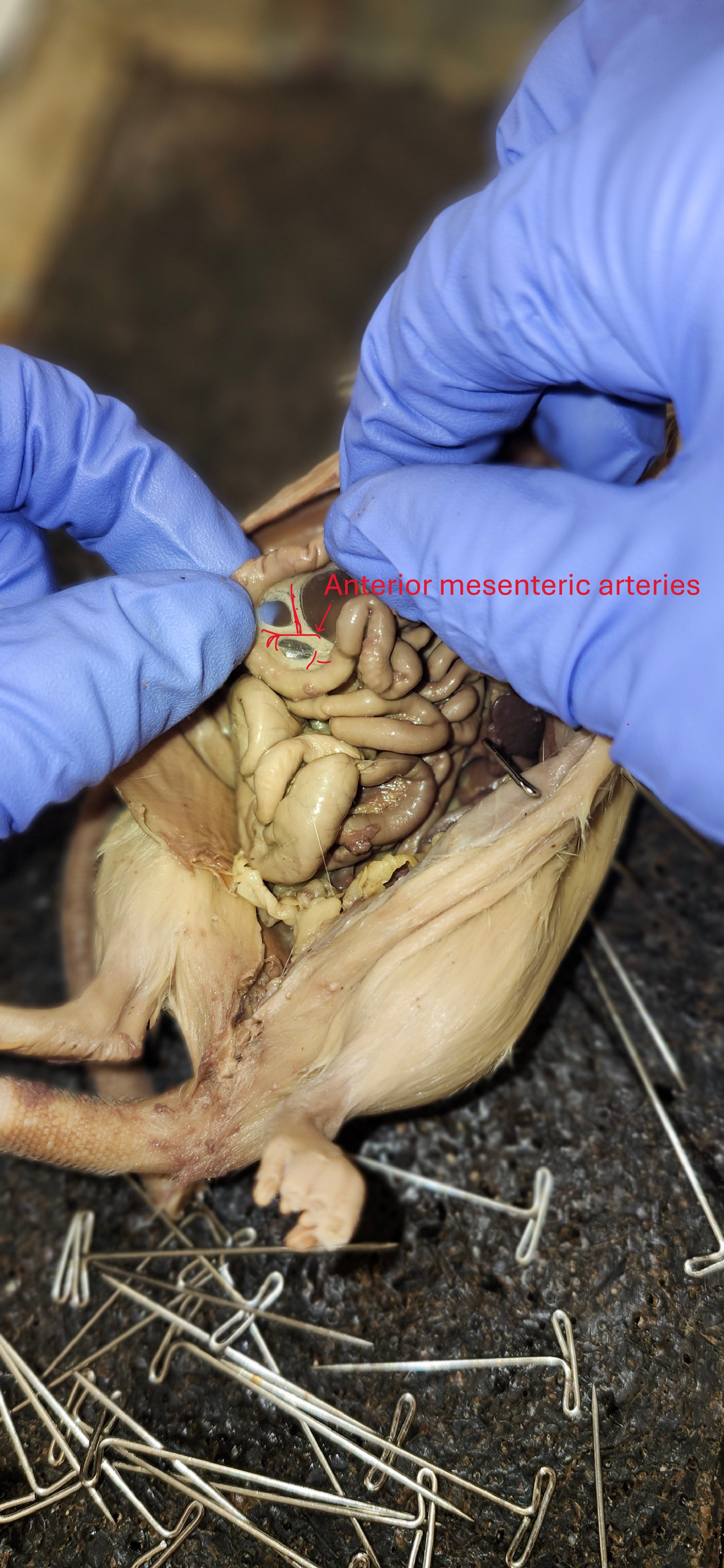 <p>Anterior mesenteric </p>