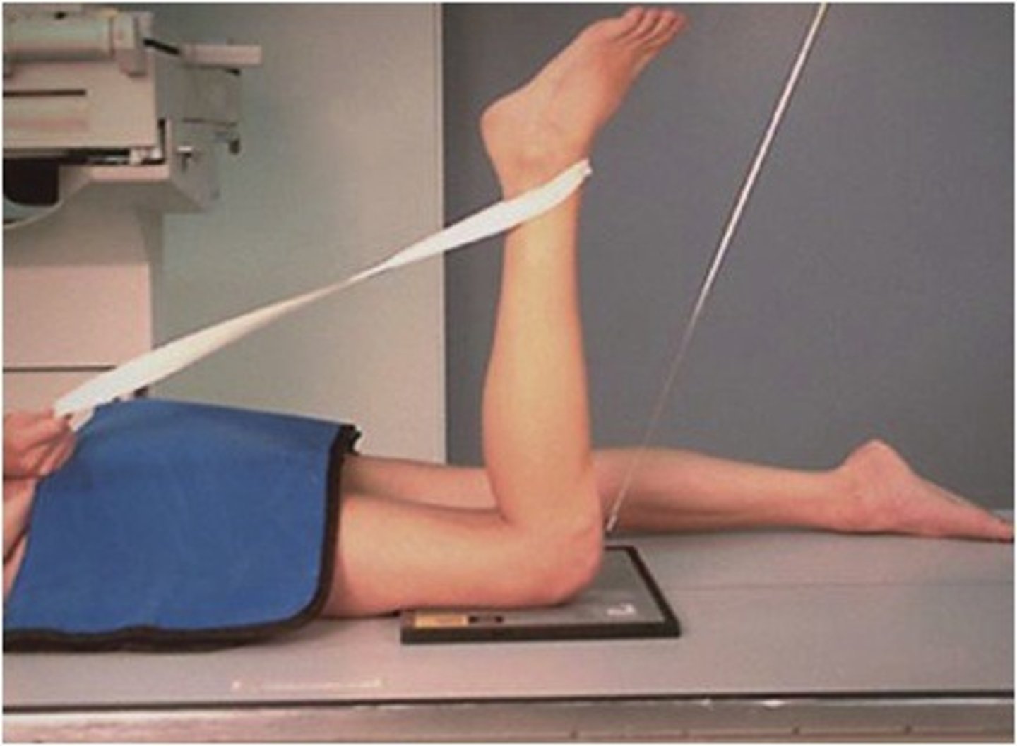 <p>S - shield over butt</p><p>T - 5 mAs @ 65 kVp</p><p>A - match joint space</p><p>M - correct marker</p><p>P - PT prone w/ leg flexed 90 degrees & toes flexed out of way, CR to joint space</p><p>S - 40"</p><p>B - suspension</p><p>C - 10 x 12 lengthwise</p>