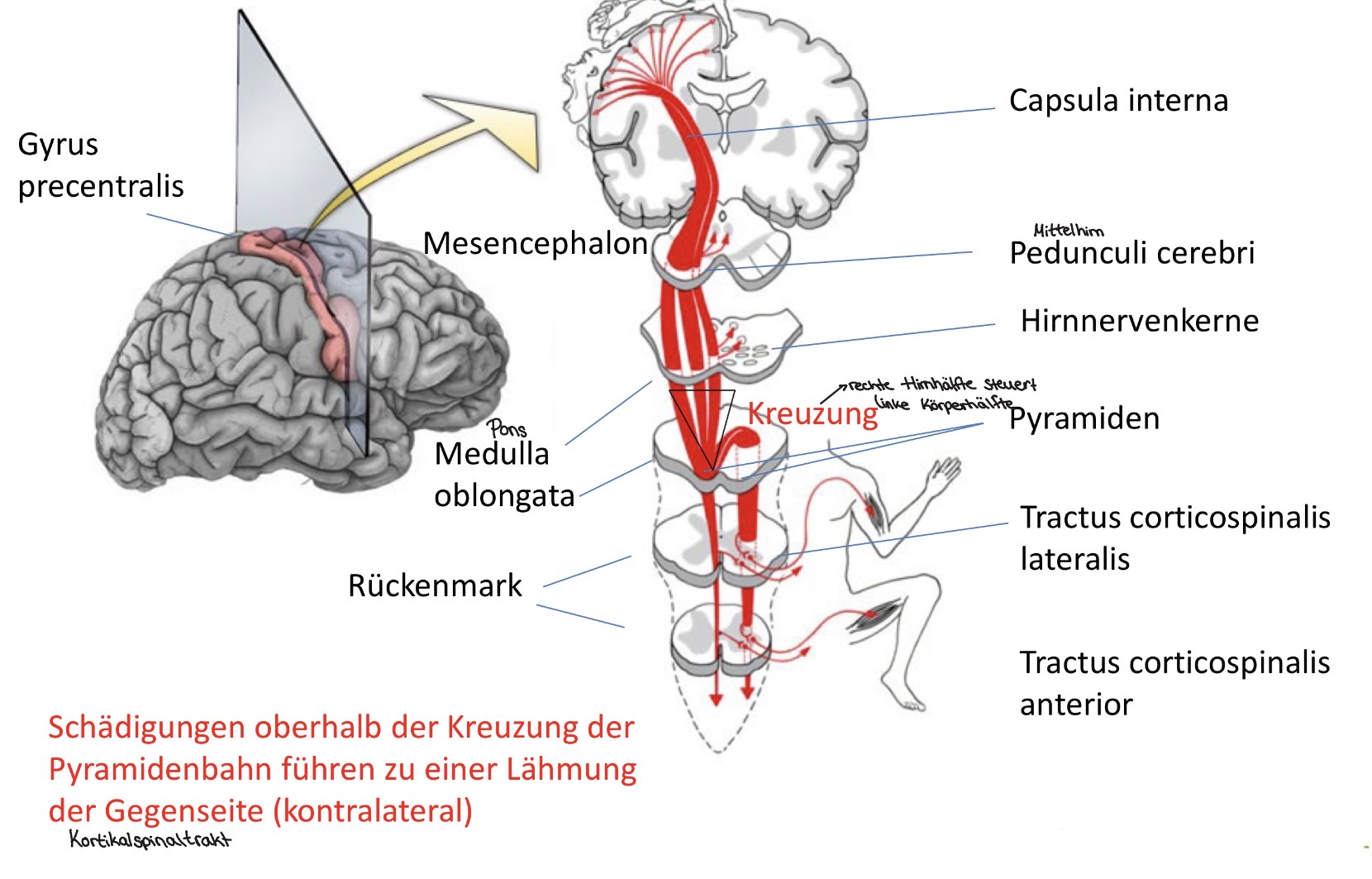 <p>Schädigungen oberhalb der Kreuzung der Pyramidenbahn führe zu einer Lähmung der Gegenseite (kontralateral) Kortikalspinalt</p>