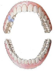<p>maxillary right second bicuspid</p>