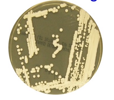 <p>Agar plate</p>