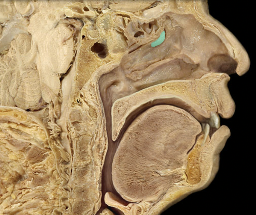 <p>Identify the feature of the nasal cavity</p>