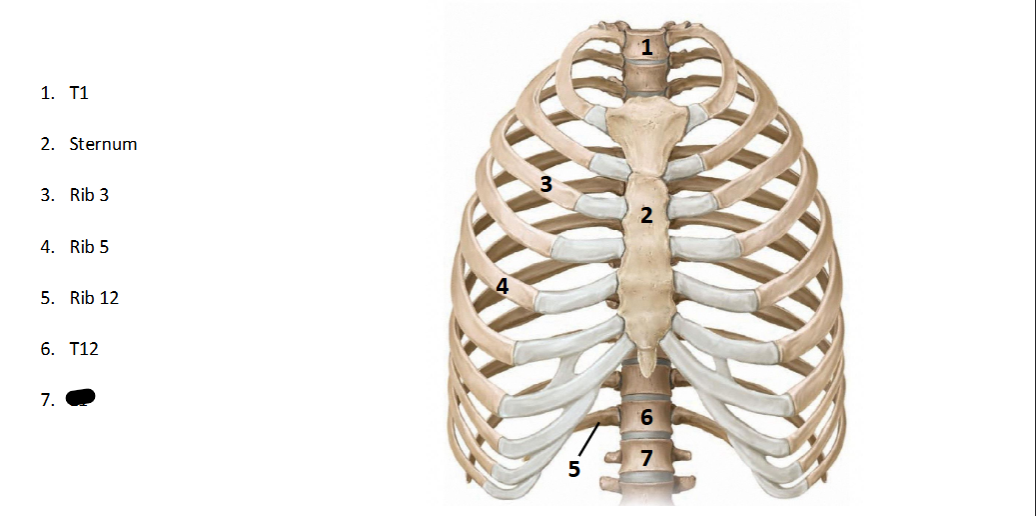 <p>What structure is this within the <strong>Spine? (ANTERIOR OF AXIAL)</strong></p>