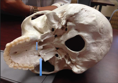 knowt flashcard image