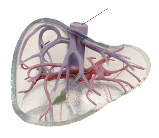 <p><span>Name the structure</span></p>