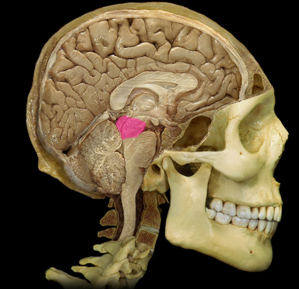 term image