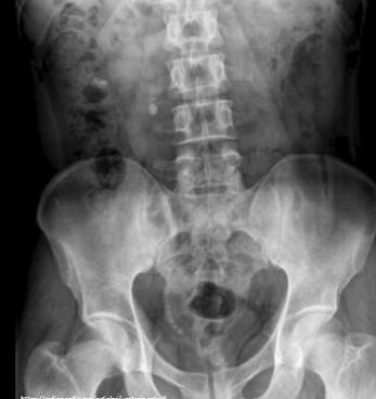 <p>What does this image show? </p>