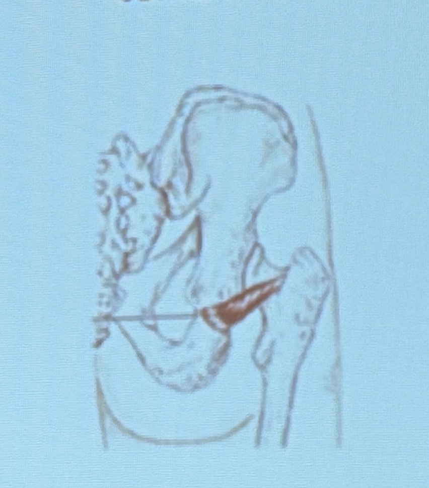 <p>Muscle name?</p>
