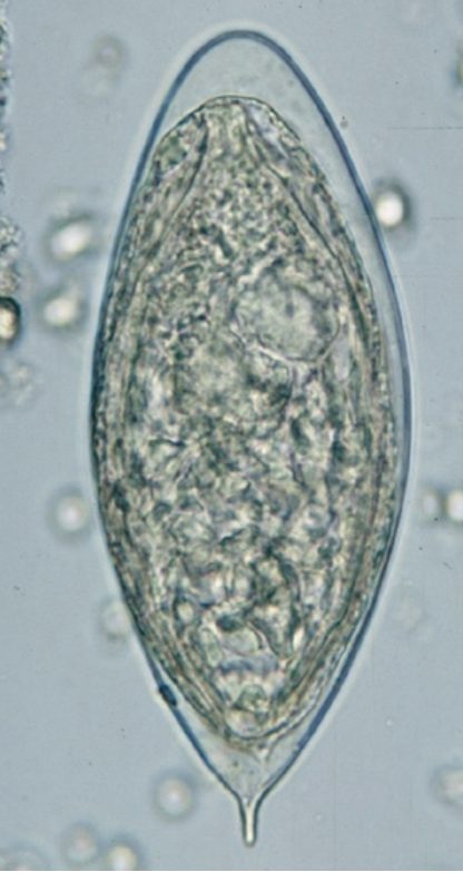 <p>-Eggs are around 150 microns long</p><ul><li><p>Can be found in stool or urine</p></li><li><p>Terminal spine</p></li></ul><p></p>