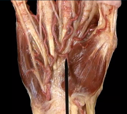 <p>Oppervlakkig, handpalm</p>