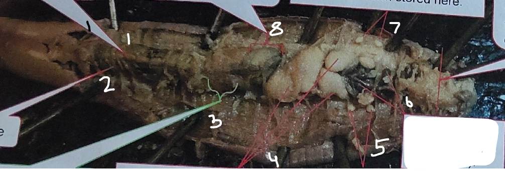 <p>What is point 3 on this earthworm </p>