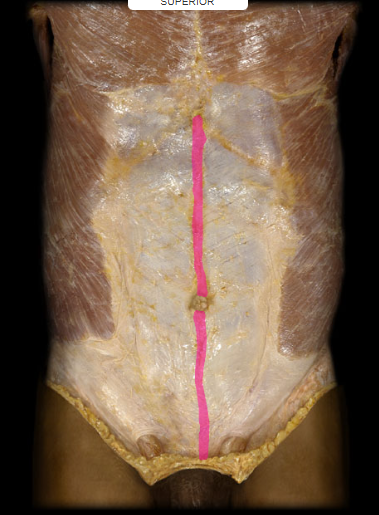 <p>this structure is <strong>NOT a muscle</strong>. It is a fibrous structure running between the xyphoid process of the sternum and the pubic symphysis. this is the insertion site for <strong>transverse abdominis.</strong></p>
