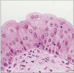 <p>name the tissue: resembles both stratified squamous and stratified cuboidal; basal cells cuboidal or columnar; surface cells dome shaped or squamous-like</p>