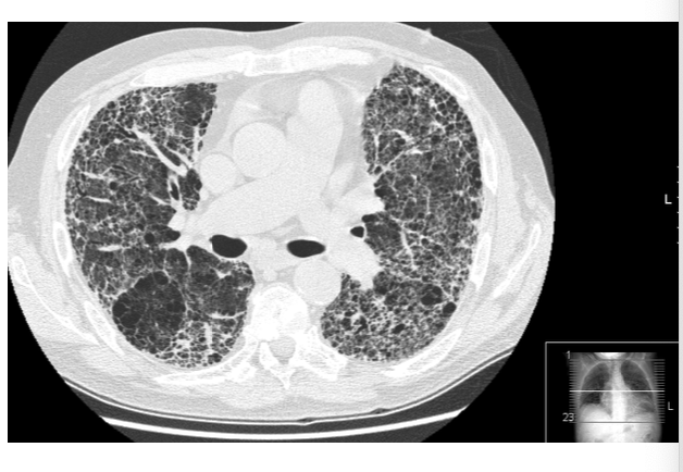 <p>what is depicted in the image? </p>