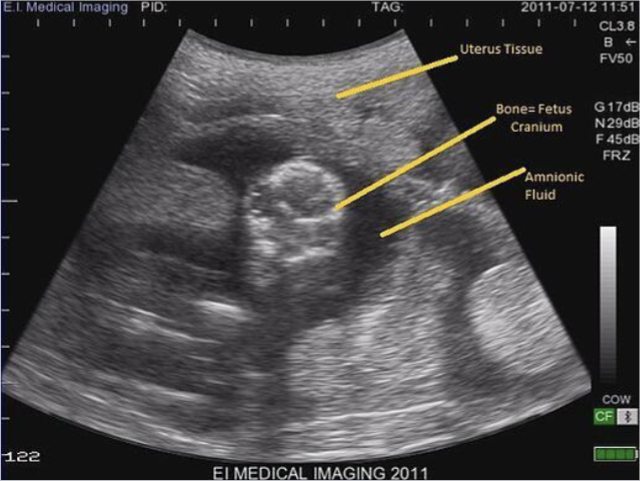<ul><li><p>Ultrasound to see things under the skin of an animal while they are alive (estimate loin eye area, fat thickness pregnancy-related characteristics)</p><ul><li><p>Different colors on the ultrasound</p><ul><li><p>White - Very dense tissue, generally bone</p></li><li><p>Grey - soft tissue like muscle (also plasma tones)</p></li><li><p>Black - Liquid (fluid)</p></li></ul></li></ul></li></ul><div data-youtube-video=""><iframe width="640" height="480" allowfullscreen="true" autoplay="false" disablekbcontrols="false" enableiframeapi="false" endtime="0" ivloadpolicy="0" loop="false" modestbranding="false" origin="" playlist="" rel="1" src="https://www.youtube.com/embed/er5dOFahxg8?si=t8-TAXaD3oXDMxMK" start="0"></iframe></div><p></p>
