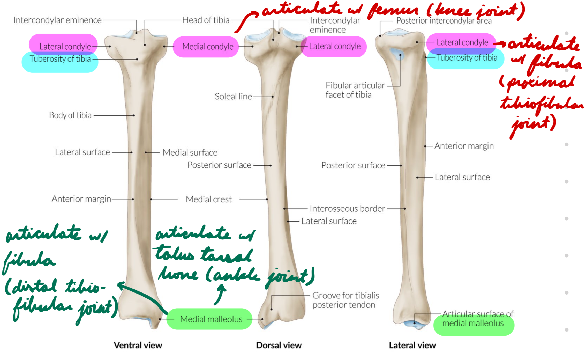 <p>Medial</p><p>Weight-bearing</p><p>Proximal:</p><ul><li><p>Condyles: bony projections</p><ul><li><p>Articulate with femoral condyles (knee joint)</p></li><li><p>Articulate with fibula (proximal tibiofibular joint)</p></li></ul></li><li><p>Tuberosity: Condyles merge → Anterior triangular region</p><ul><li><p>Patellar tendon attachment</p></li></ul></li></ul><p>Distal:</p><ul><li><p>Medial Malleolus: Bony projection</p></li><li><p>Articulate with fibula (distal tibiofibular joint)</p></li><li><p>Articulate with talus tarsal bone (talocrural/ankle joint)</p></li></ul><p></p>