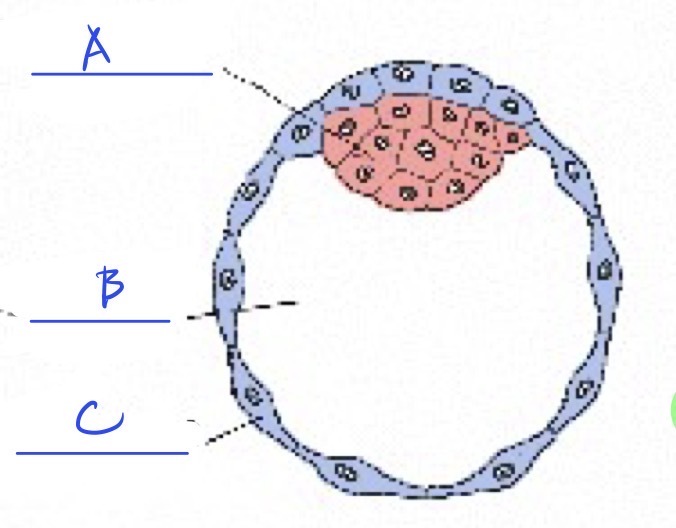 <p><span style="line-height: 20.85px;">Can you ID the parts of a blastocyst mentioned in class?</span></p>