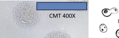 <p>ID the type of yeast </p>