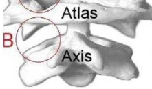 <p>What is this joint?</p>