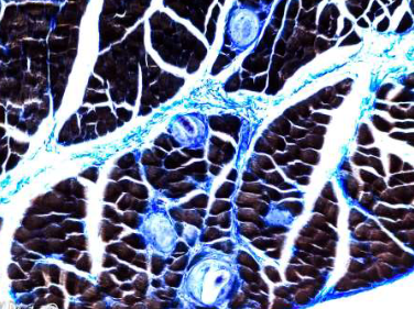 <p><strong>Phylum:</strong> Nematoda</p><p>Trinchella encysted in vertebrate skeletal muscle</p>