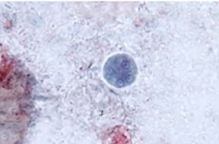 <p><span style="background-color: rgba(0, 0, 0, 0); line-height: 19.7625px;">What is the species seen in this photo and WHY?</span></p>