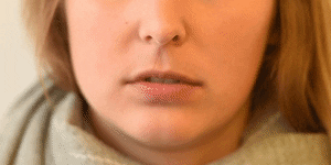 <p>Lip Puckerer</p>