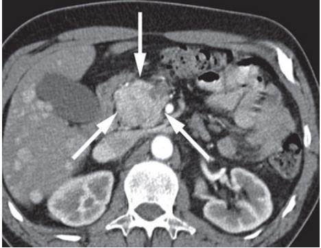 <ol><li><p>Imenuj tehniko slikanja </p></li><li><p>Naštej anatomske strukture, prikazane na sliki </p></li><li><p>Kateri je položaj slikanja? </p></li><li><p>Opiši patološke spremembe na sliki </p></li><li><p>Diagnoza?</p></li></ol><p></p>