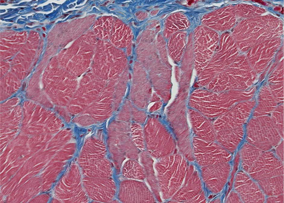 <p><span style="font-family: "Calibri Light";">ID the type of muscle in this esophagus section.</span></p>