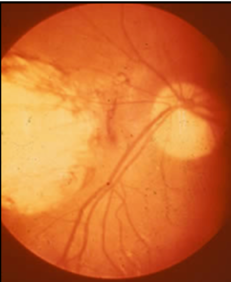 <p>disease and severity or state</p>