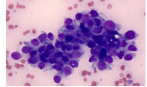 <p>What is this a cytology of?</p>