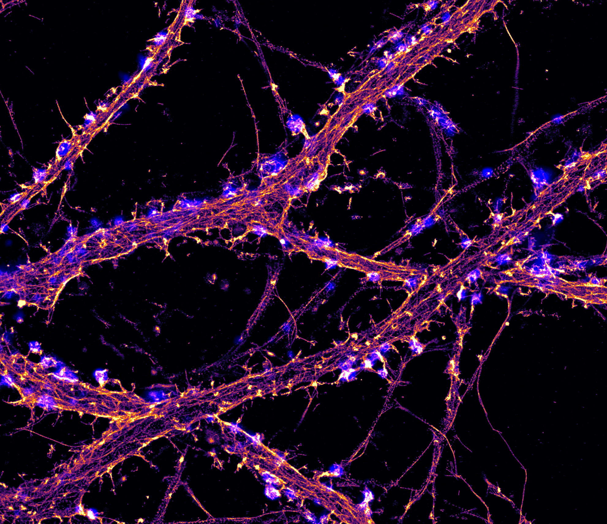<p>describe super resolution</p>