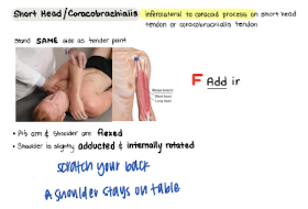 <p>F Add IR</p>