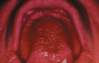 <p>what is this condition </p>