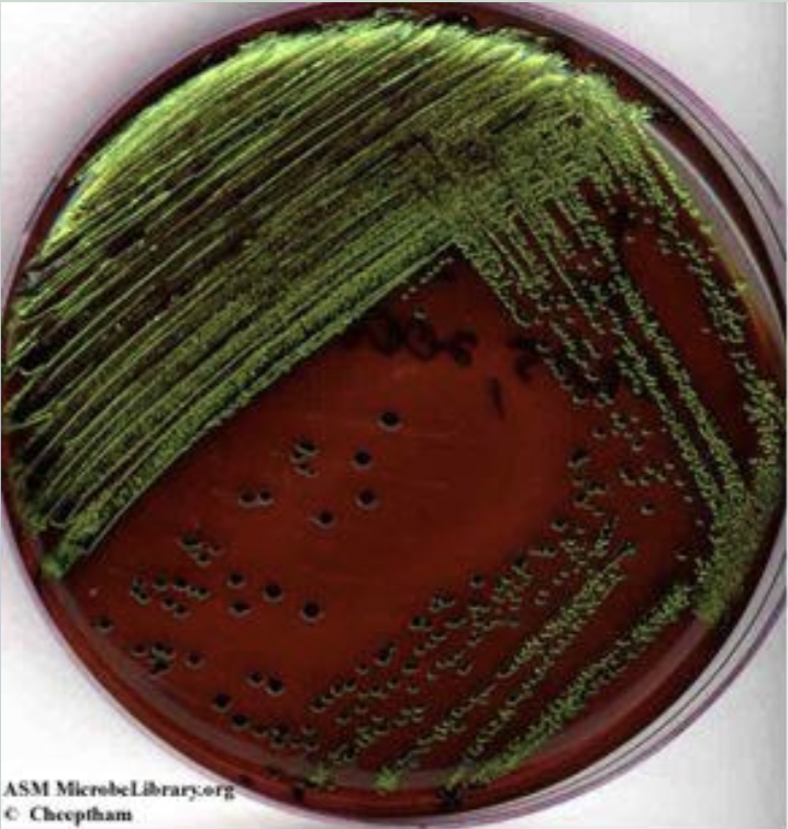 <p>Water tests (results) </p>