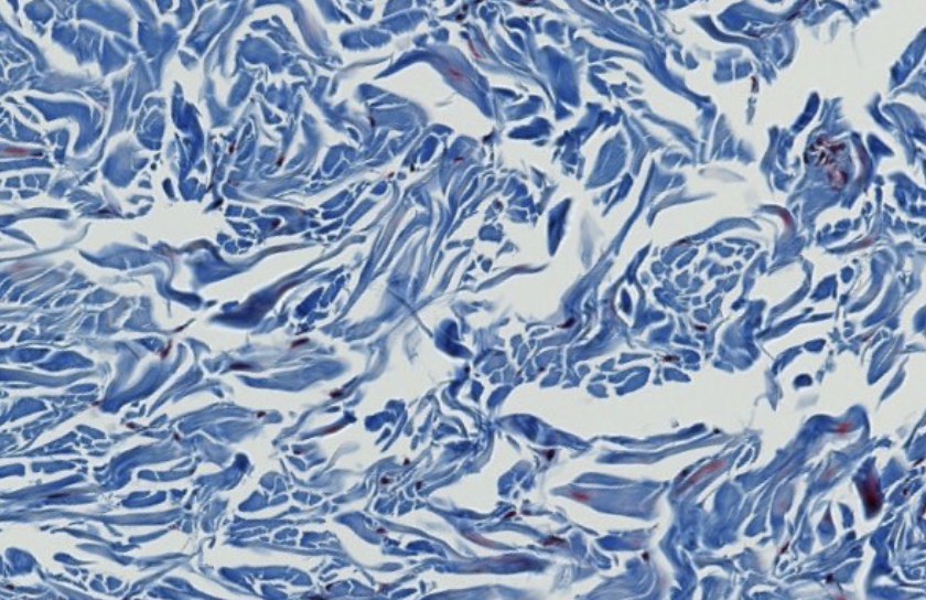 <p>what type of CT is this? be specific.</p>
