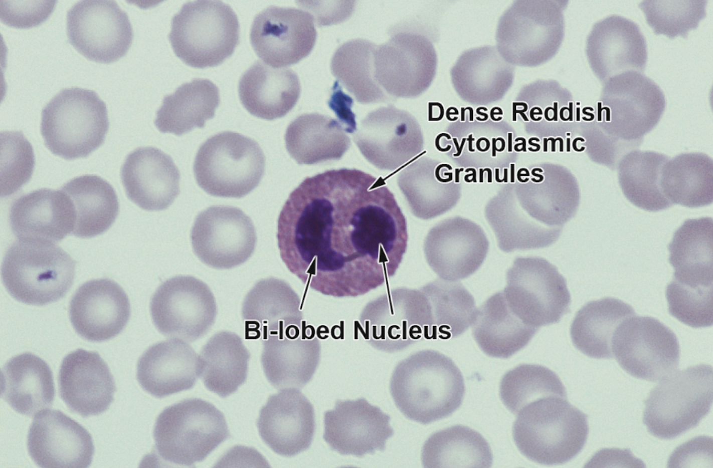 <p><span style="background-color: rgba(0, 0, 0, 0); line-height: 19.55px;">RED bi-lobed nucleus</span></p>