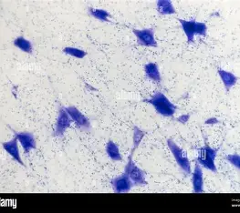 <p>Which kind of tissue is shown?</p>