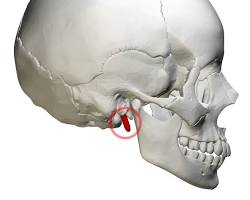 <p>What is this pointing to? What bone is it on?</p>